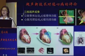 超声课堂：冠心病超声新技术的应用（一）视频封面