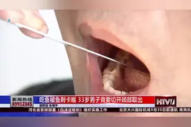 鱼刺卡喉咙竟要这样取出！小伙症状让医生吃惊，严重会有生命危险视频封面
