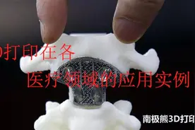 3D打印技术在医疗各个领域的应用实例图片