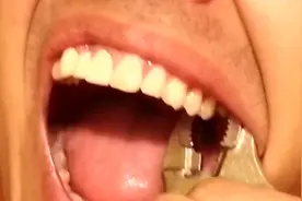 老外不愿意看到牙医，自己在家老虎钳拔牙，接着两眼泪汪汪