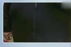 500斤小伙成功减肥270斤，做10小时手术去除赘皮