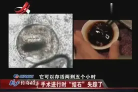 寄生虫生命力顽强，带来危害如此大，男子仍需要继续治疗视频封面