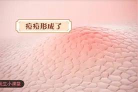 动画展示痘痘的形成过程，涨知识了！