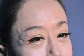 血管凸出，青筋暴起，你病了吗？视频封面