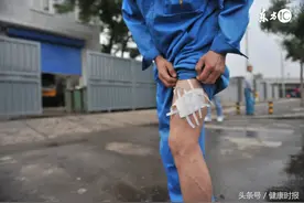 季节更替狗咬人事件多发 被狗咬后怎么办？图片