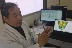 专访｜沈国芳：整形龅牙和地包天，可数字化定制图片