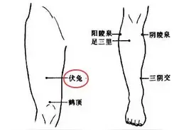 辟谣特工队｜拍打大腿就能治疗腰痛吗？图片