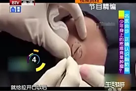 少年身上莫名奇妙长疙瘩，刺痒难受，竟然是肿瘤？这是怎么回事？视频封面