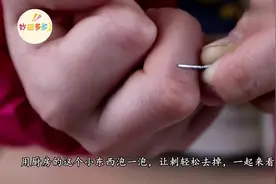 手上扎了刺别再用针挑了，用厨房这几样东西泡一泡，轻松去除视频封面