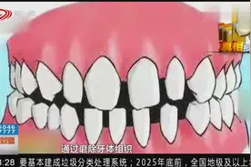 最近风靡的“七天快速矫正牙齿法”是真的吗？专家：不可能！视频封面
