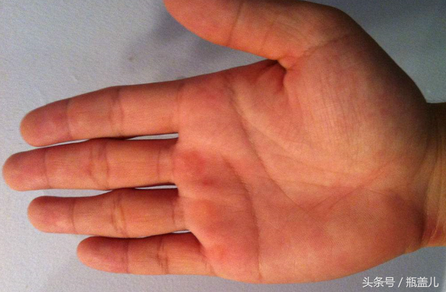 事业线,生命线(不知道大家怎么叫)断掌就是最上那条线直接横切手掌