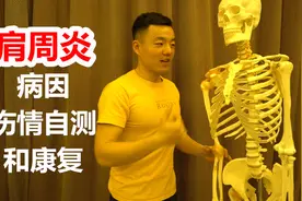 肩周炎的形成原因清楚了，预防和康复就好办了，附自测方法视频封面