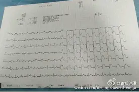 大年初二，急诊人为他祈祷——垂杨柳医院急诊实录图片