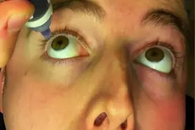 美国发明超强眼药水，滴一滴拥有夜视能力，现实版血轮眼