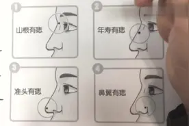 鼻子长痣解读运势，不同位置寓意不同，你有哪些