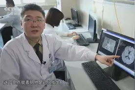 脑梗要分秒必争！医生解释：发生脑梗每分钟会死亡一两百万脑细胞视频封面