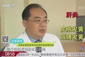 尿液发黄居然与肝脏疾病有关，如果出现这些症状，一定要抓紧就医视频封面