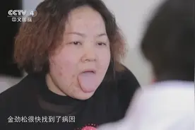 女子患肾病综合征，中医开“五苓散”古方，其茯苓的用法还挺特殊视频封面