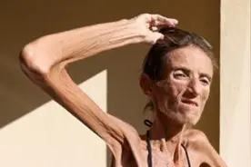 世界上最瘦的女模特 全身上下加起来竟然只有50斤视频封面