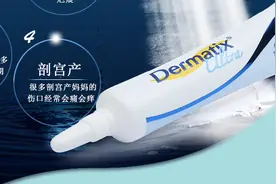 倍舒痕和芭克哪个抗疤痕软膏效果好？图片