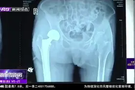 伤筋动骨一百天？106岁老人髋骨骨折，术后第二天竟就能下地走路视频封面