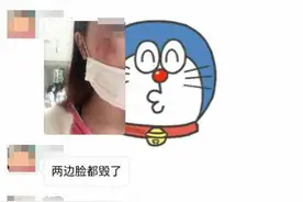 南昌一化妆跑活动被指致多名跑友毁容，举办方：系过敏性皮炎图片