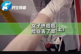 嘴唇上方长米粒大小的痘痘，女子随手一挤险些丢了命！（上）@抖音小助手