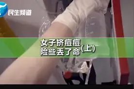 嘴唇上方长米粒大小的痘痘，女子随手一挤险些丢了命！（上）@抖音小助手视频封面