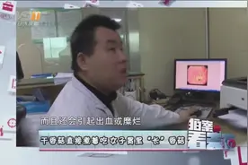 干香菇直接煮着吃，女子胃里“长”香菇，医生果断手术分次取出视频封面