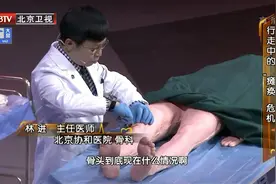 走路为什么会外八、内八或者O型腿呢？罪魁祸首竟是它！