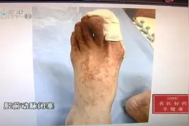 男子脚痛像被开水烫、针扎一样，上医院一查，竟是坏习惯惹的祸视频封面