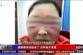 女子狂吃马兰头，结果面目全非，医生的话解开众人的疑惑视频封面