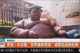 减肥成功也苦恼？印尼前“世界最胖男孩”减肥后皮肤松弛，闹心!视频封面