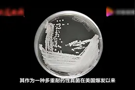 国内已有18例超级真菌确认感染