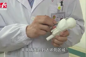 全球首例！男子股骨头坏死,医院“3D打印+仿生”技术保住髋关节视频封面