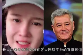 赵本山女儿球球变脸，整牙脸部肿成面包，吓坏网友