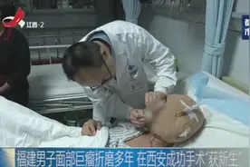 福建男子面部巨瘤折磨多年，在西安成功手术“获新生”视频封面