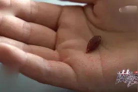 误吞枣核可能肠穿孔，看一位医生的自救，化险为夷，简直是教科书