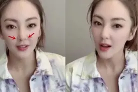 张雨绮开直播变蛇精脸左右不对称，鼻子也歪了一高一低视频封面