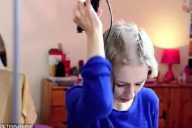 杭州21岁漂亮女孩8年拔光了满头秀发 课业压力大靠图片