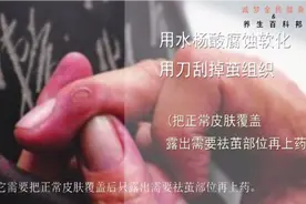 想除去指甲缝边的茧子，试试这些方法，不用剪刀也能行视频封面