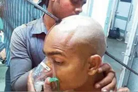 铁棒穿脑奇迹生还 印度男子遭2米长铁棒刺穿脑袋获救图片