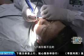 明明自己每天早晚刷牙，为什么还会得牙周炎呢？口腔医生来解答视频封面