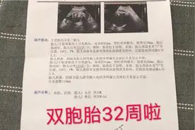 小伙带老婆去做产检，双胞胎32周宝宝才4斤算小吗？视频封面