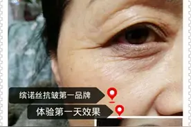 缤诺丝如何赚钱？缤诺丝什么效果？图片