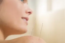 针灸治疗肩周炎 就取这几个穴位图片
