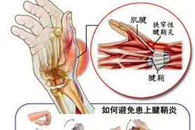 “手机奴”福音 这样玩手机不伤手图片