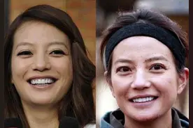 只要美人鱼不要鱼尾纹   眼纹的形成原因及其改善方法图片