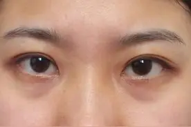 黑眼圈怕什么？瑜伽体式单手弓式练起图片