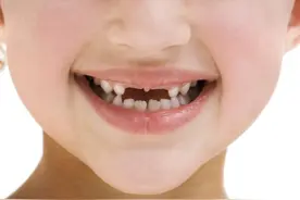 宝宝在牙齿萌出时都会发生哪些异常？图片